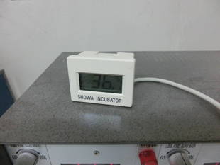 コンドルの産卵