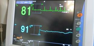 アビシニアコロブスの健康診断